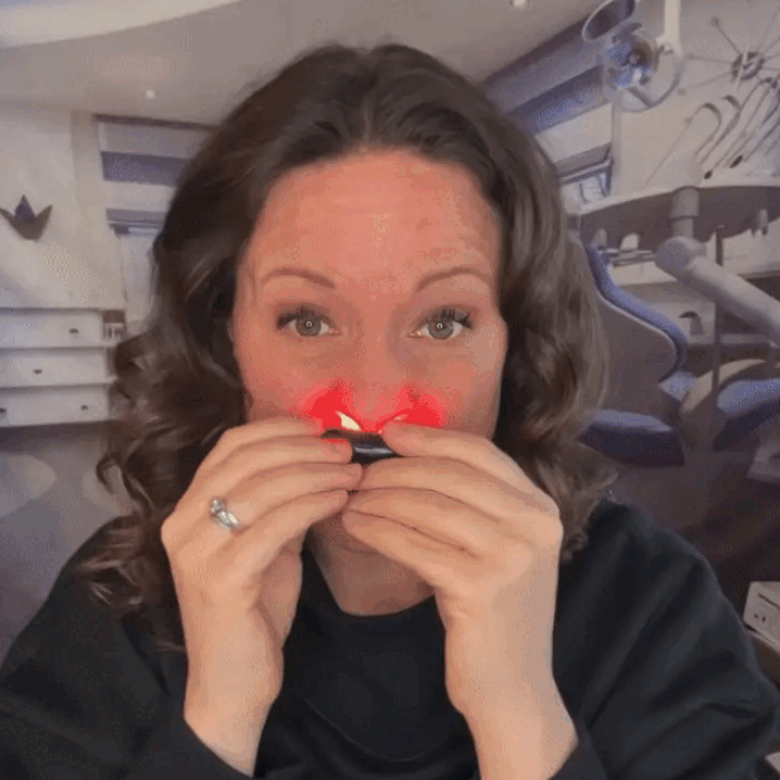 Rylaro™ Dispositivo de luz vermelha nasal