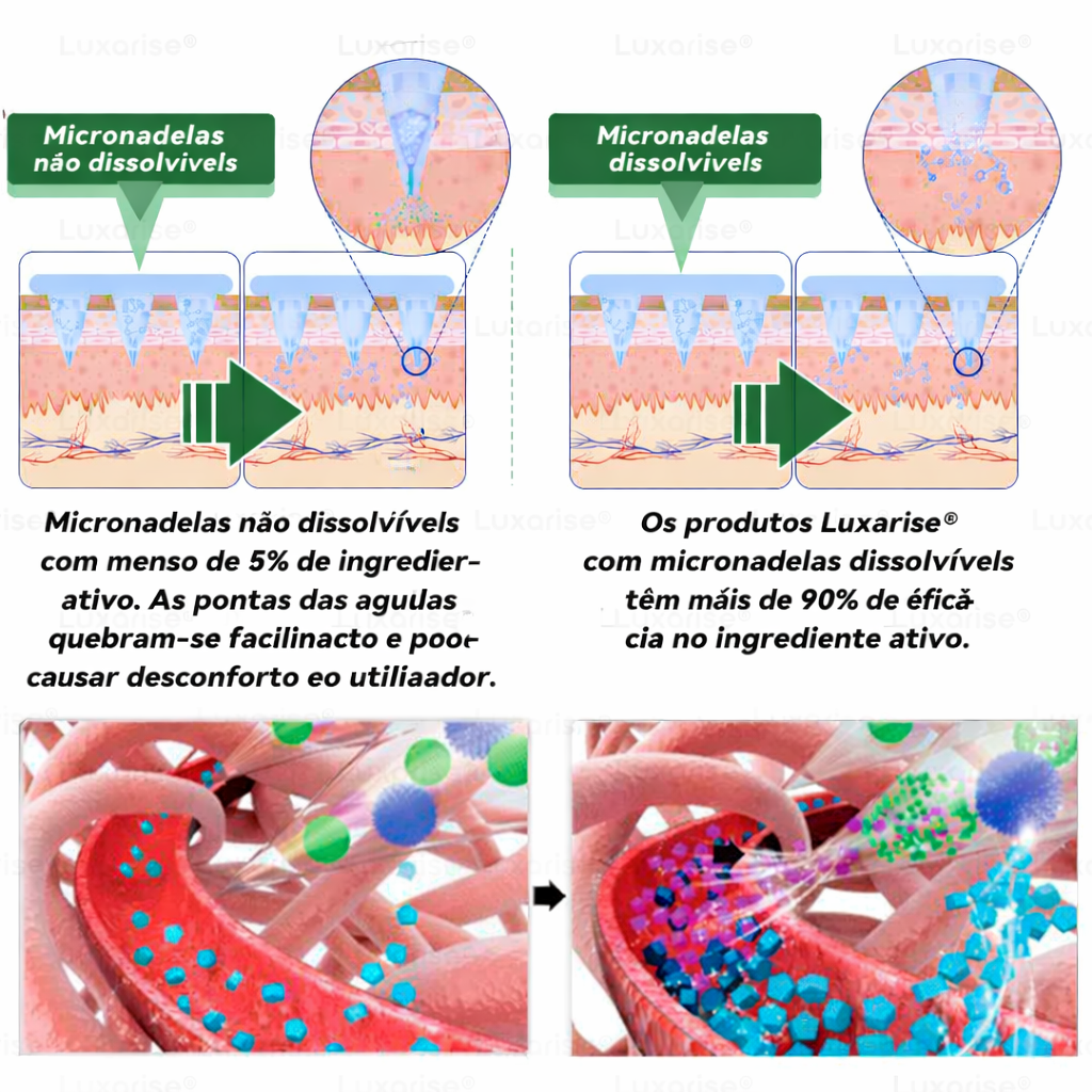 Rylaro™ Adesivo para emagrecer